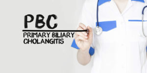 Primary Biliary Cholangitis Archives - LiverSupport.com